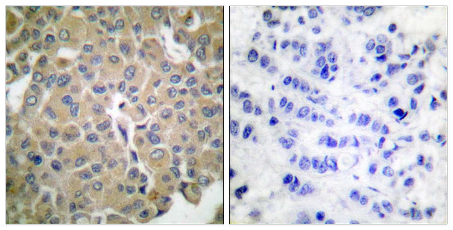 MLANA / Melan-A Antibody