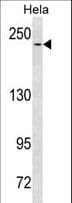 Monoclonal Mouse anti-Human NOTCH3 Antibody (aa2291-2321, WB)