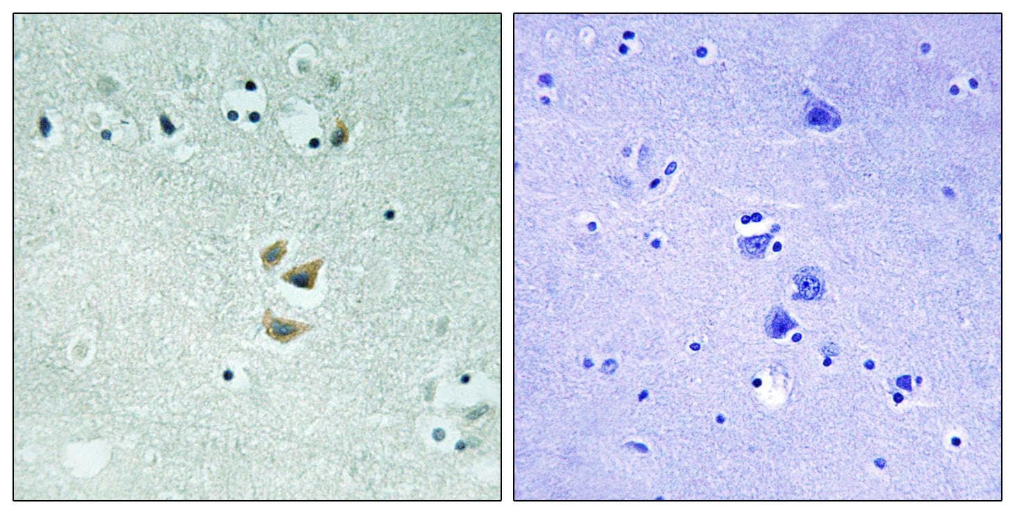 PRKCA / PKC-Alpha Antibody