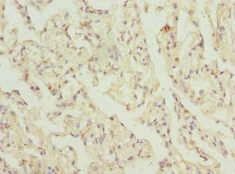 Polyclonal Rabbit anti-Human ELMOD1 Antibody (IHC)