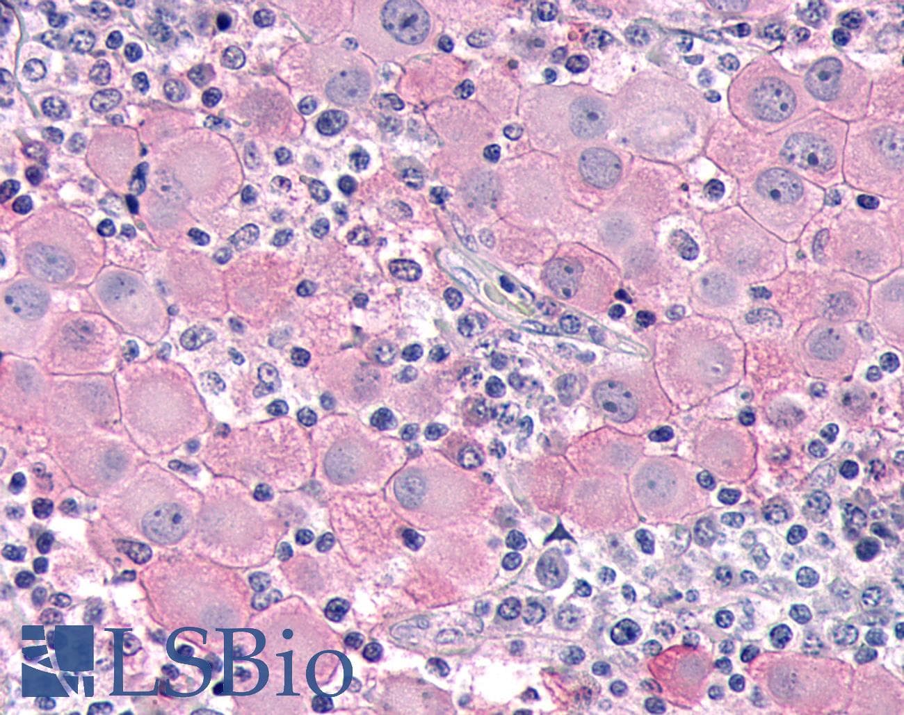 PathPlus™ Polyclonal Rabbit anti-Human DUSP26 / MKP8 Antibody (Internal, IHC)