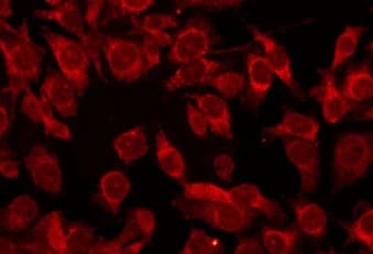 Polyclonal Rabbit anti-Human COL17A1 / Collagen XVII Antibody (IHC, IF, WB)