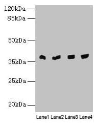 Polyclonal Rabbit anti-Human Transaldolase Antibody (IHC, WB)