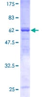 Human SNX7 Protein (Recombinant GST)