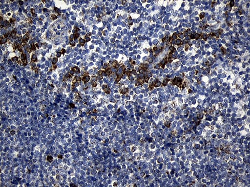 PCCA Antibody (clone OTI1E9, Carrier-free)
