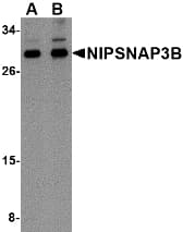 IHC-plus™ NIPSNAP3B Antibody