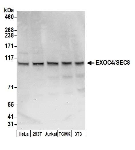 Polyclonal Rabbit anti-Human EXOC4 / SEC8 Antibody (aa924-974, WB)