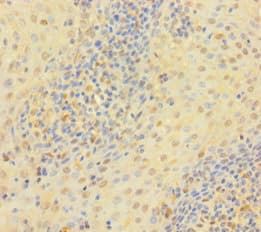 Polyclonal Rabbit anti-Human TP / Thymidine Phosphorylase Antibody