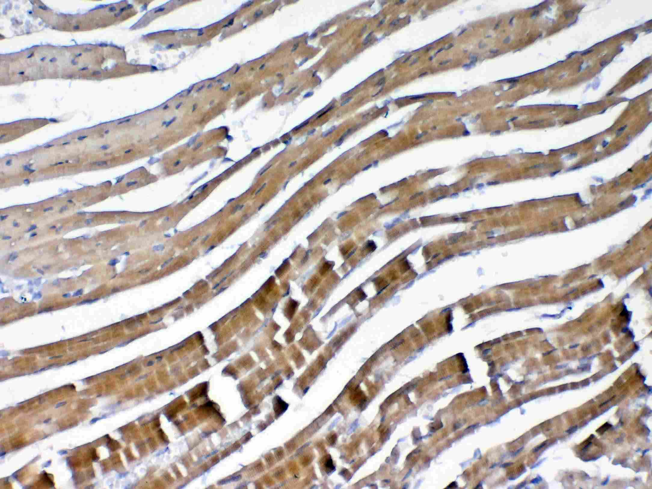VEGFB Antibody
