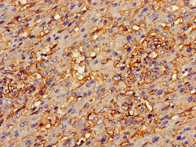Polyclonal Rabbit anti-Human ANXA2 / Annexin A2 Antibody (aa2-339, IHC, WB)