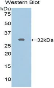 GJA5 / CX40 / Connexin 40 Antibody (aa50-303)