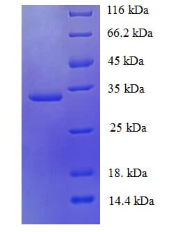Human MMS2 / UBE2V2 Protein (Recombinant His-SUMO)