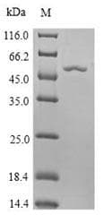 Agrobacterium 3-phosphoshikimate 1-carboxyvinyltransferase Protein (Recombinant 6His, N-terminus)