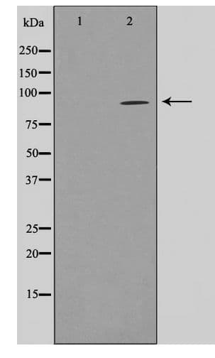 Polyclonal Rabbit anti-Human FASTKD1 Antibody (WB)