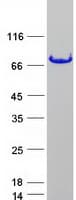 Human FUS / TLS Protein (Recombinant Myc-DDK (Flag))