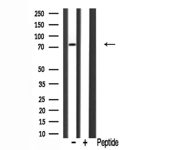 DCLK2 / DCAMKL2 Antibody