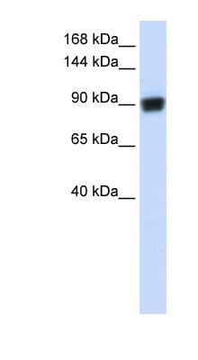 RAD54B Antibody (aa144-193)