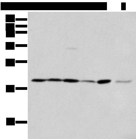 EEF1E1 / AIMP3 Antibody