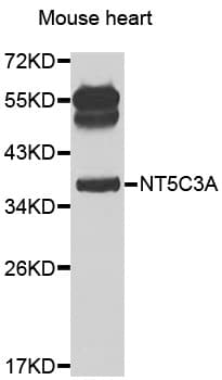 Polyclonal Rabbit anti-Human NT5C3A Antibody (WB)