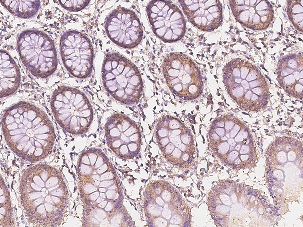 IDH3B Antibody