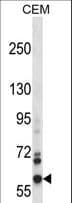 NOX5 Antibody (aa680-709)