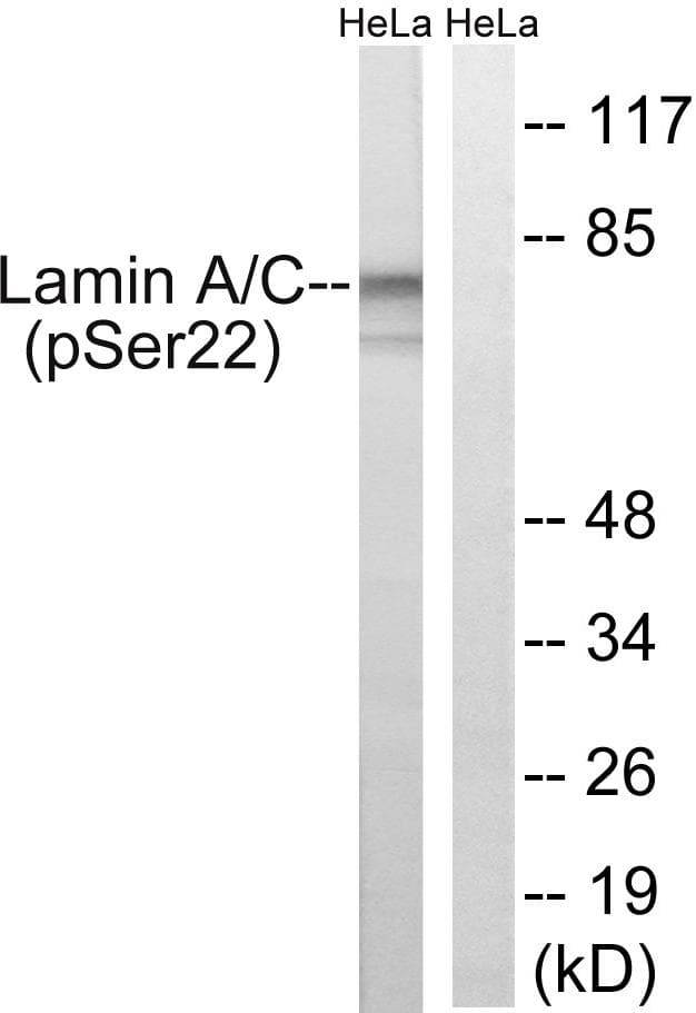 LMNA / Lamin A+C Antibody (phospho-Ser22)