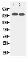 Polyclonal Rabbit anti-Human TJP2 / ZO2 / ZO-2 Antibody (aa1171-1190, IHC, WB)