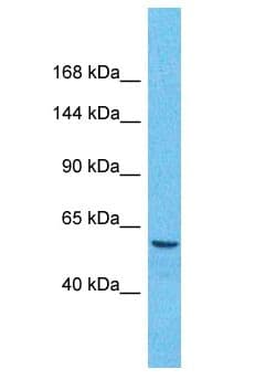 TARSH / ABI3BP Antibody (aa921-970)