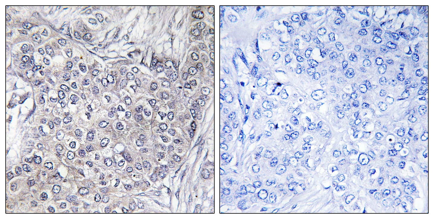 Polyclonal Rabbit anti-Human EIF4EBP1 / 4EBP1 Antibody (phospho-Thr45, IHC, WB)