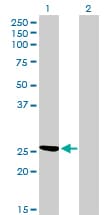 CLIC3 Antibody (clone 3F8)