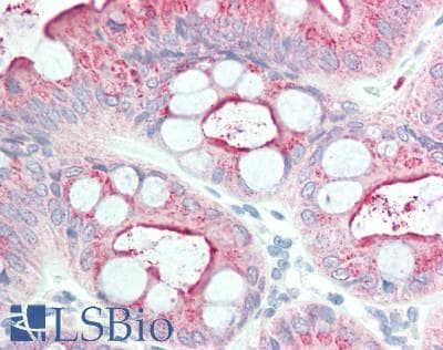 IHC-plus™ CEACAM8 / CD66b Antibody