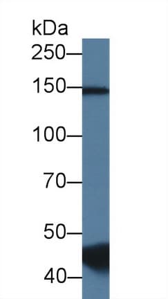 RBM20 Antibody (aa1089-1227)