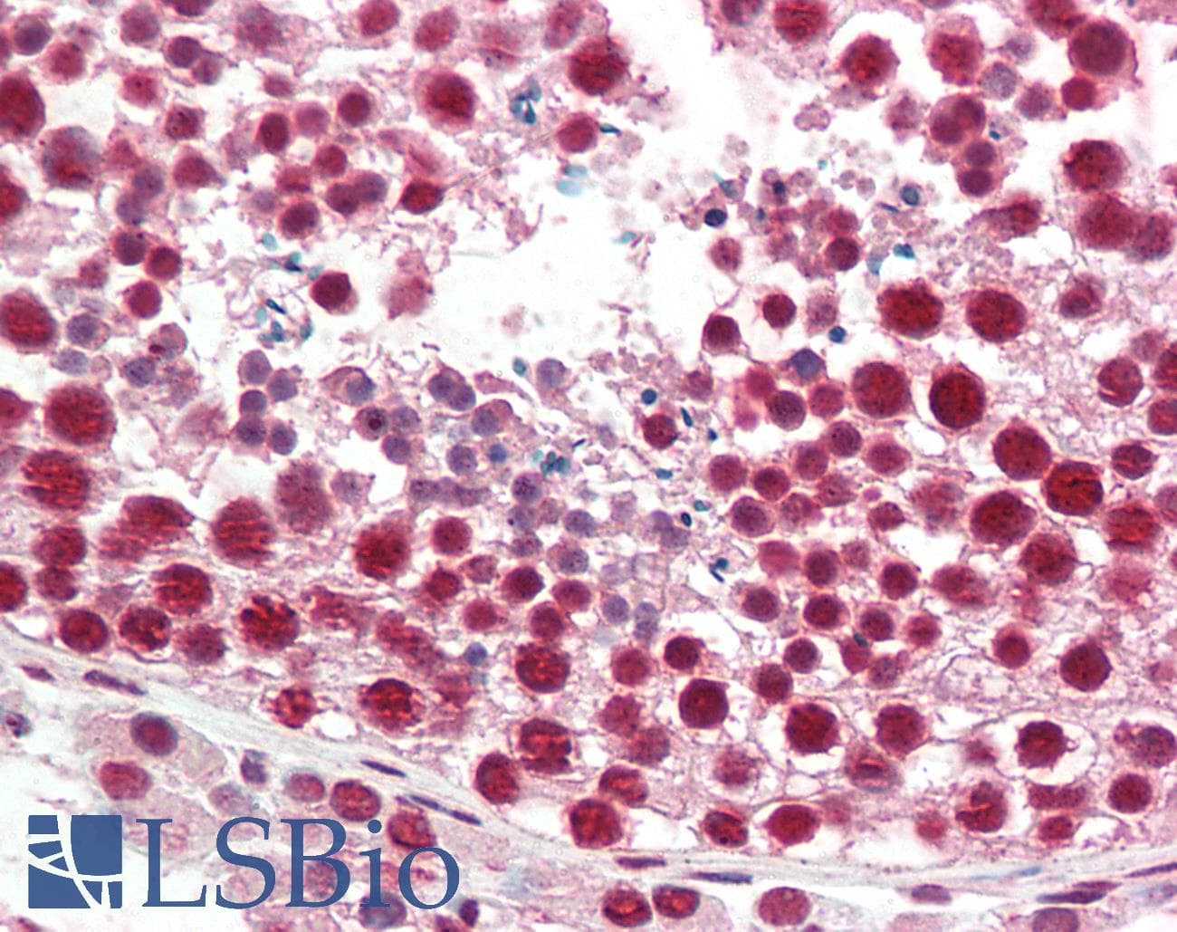 IHC-plus™ Polyclonal Goat anti-Human HNRNPA2B1 Antibody (aa127-137, IHC, WB)