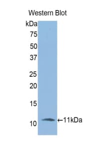 IL6R / IL6 Receptor Antibody (aa19-108)