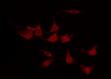 ERBB2 / HER2 Antibody (phospho-Tyr877)