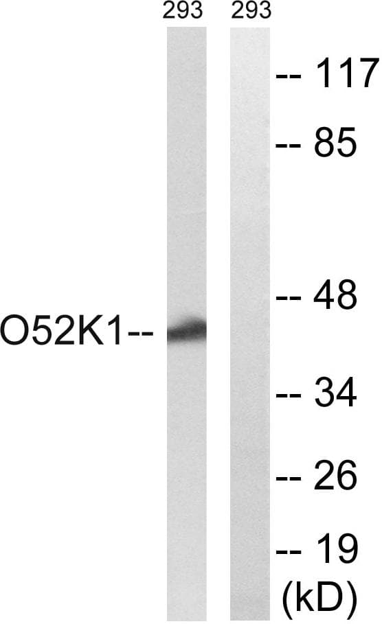 OR52K1 Antibody