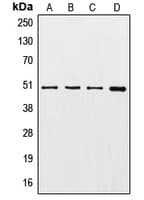 Polyclonal Rabbit anti-Human TUBG1 / Tubulin Gamma 1 Antibody (C-Terminus, IHC, WB)