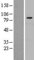 Human Complement C7 Protein (Over-Expression Lysate Myc-DDK (Flag))