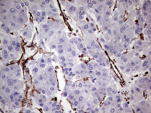 Vimentin Antibody (aa210-466, clone UMAB159)