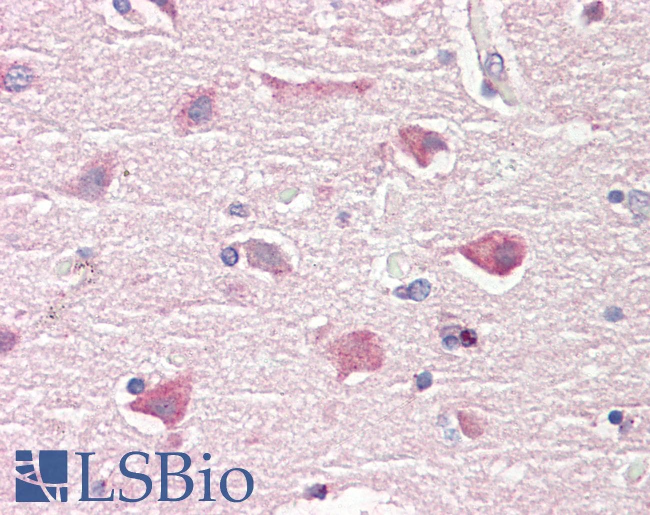 IHC-plus™ Polyclonal Rabbit anti-Human ITPK1 Antibody (aa81-130, IHC, WB)