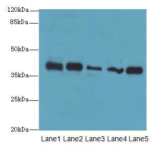 KHDRBS2 / SLM-1 Antibody