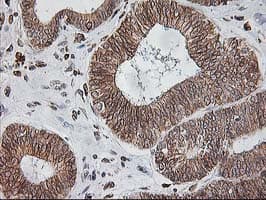 SSR1 Antibody (clone OTI3E5)