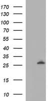 LGALS3 / Galectin 3 Antibody (clone OTI1A1)
