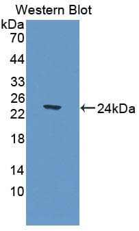 CNDP1 Antibody (aa332-507, Biotin)
