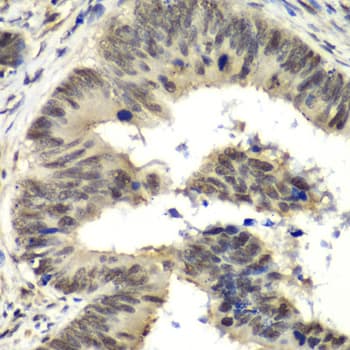 NELFE / RD / RDBP Antibody