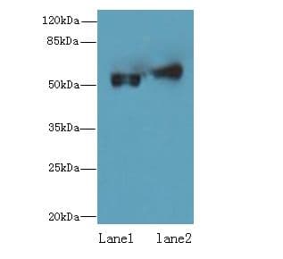 Polyclonal Rabbit anti-Human CFLAR / FLIP Antibody (IHC, WB)