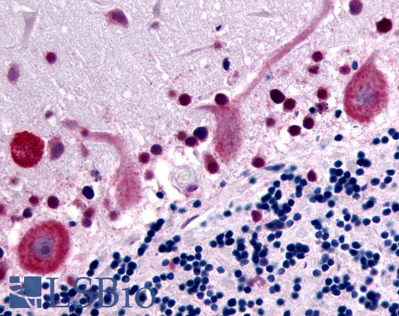 IHC-plus™ GPR32 Antibody (Cytoplasmic Domain)