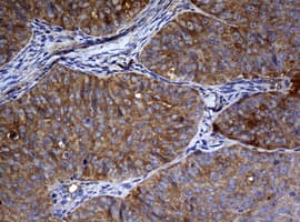 NME1 / NM23 Antibody (clone OTI1A12)