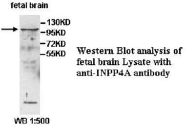 Polyclonal Rabbit anti-Human INPP4A Antibody (aa601-812, IHC, WB)