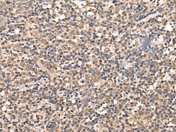 Polyclonal Rabbit anti-Human ZSCAN12 Antibody (IHC)